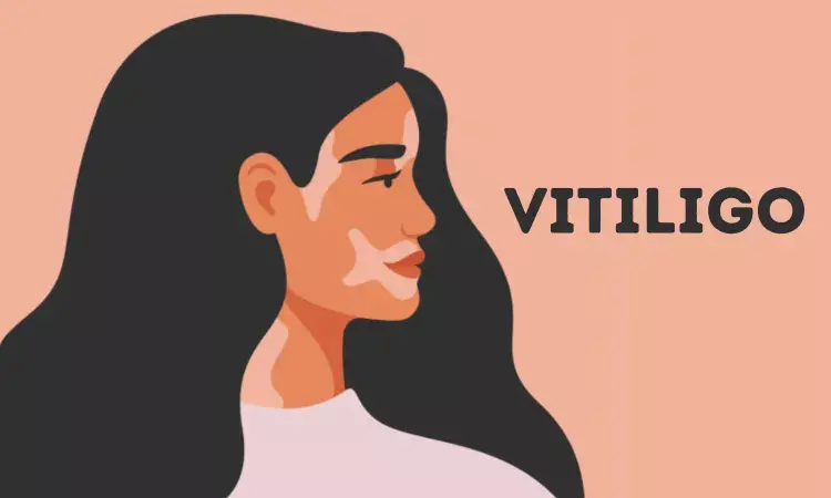 Increased retinal detachment risk observed among vitiligo patients: Study