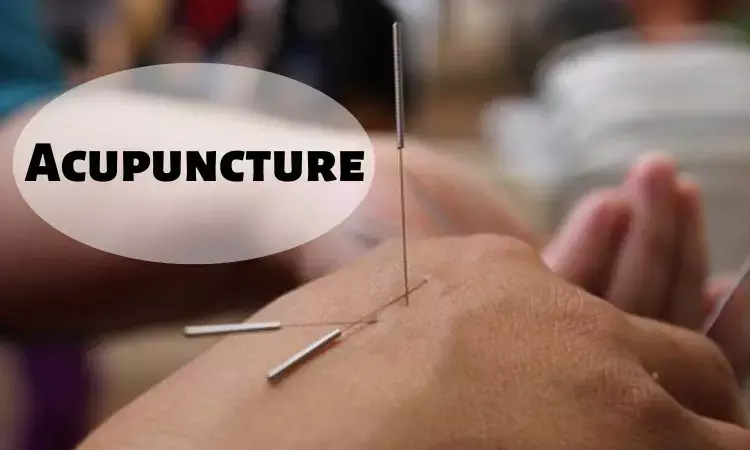 Acupuncture may Improve Outcomes of Chronic Urticaria