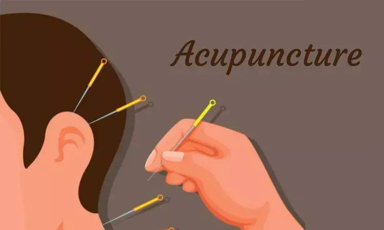Ear acupuncture stimulation with beads may be helpful for weight loss