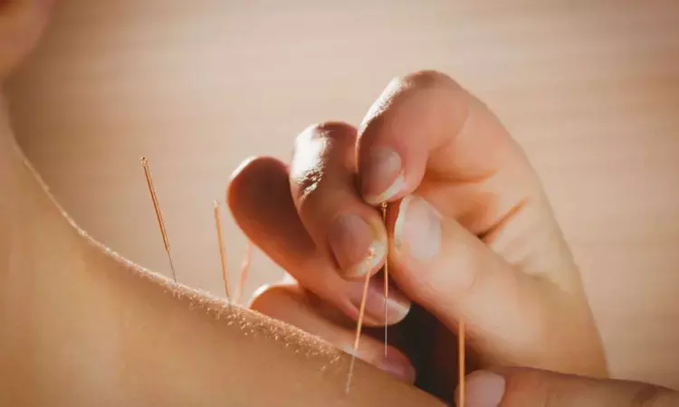 Manual acupuncture improves language function in poststroke motor aphasia: JAMA