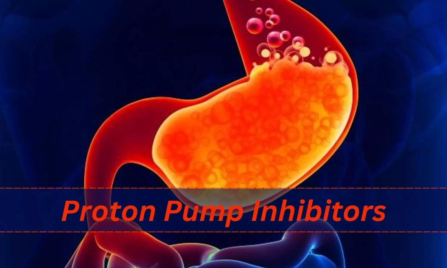 Proton pump inhibitor use tied to CVD and mortality in type 2 diabetes patients