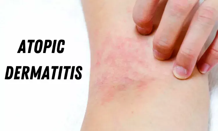Topical JAK inhibitors effective against atopic dermatitis