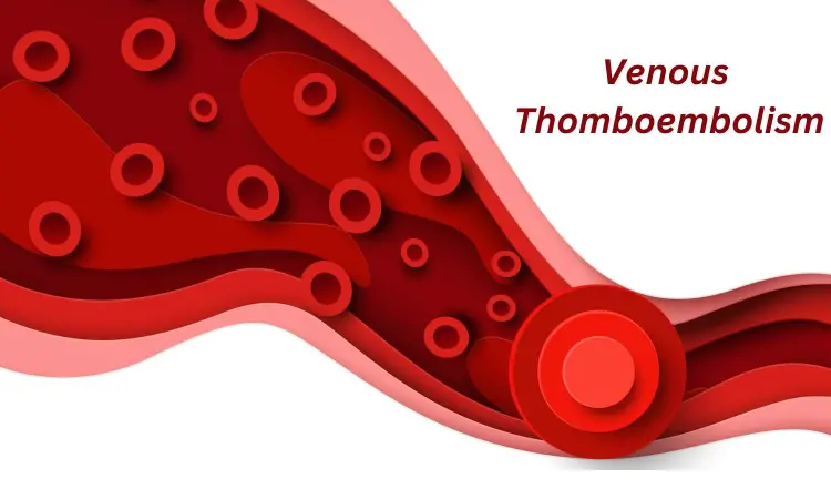 Cancer surgery linked to increased venous thromboembolism risk: JAMA