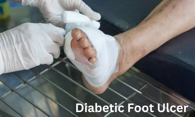 Diabetic foot complications tied to increased risk of all-cause mortality in type 2 diabetes patients