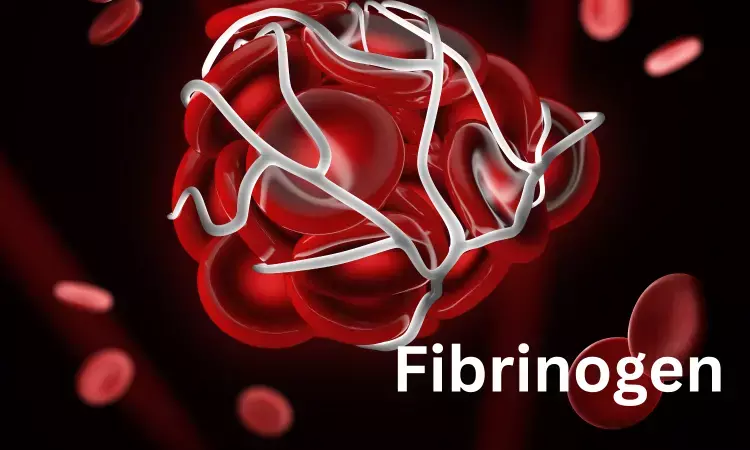 Fibrinogen concentrate cost-effective than cryoprecipitate for managing bleeding in cardiac surgery patients: JAMA