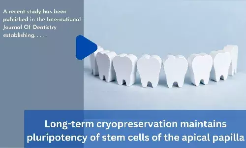 Long-term cryopreservation maintains pluripotency of stem cells of the apical papilla