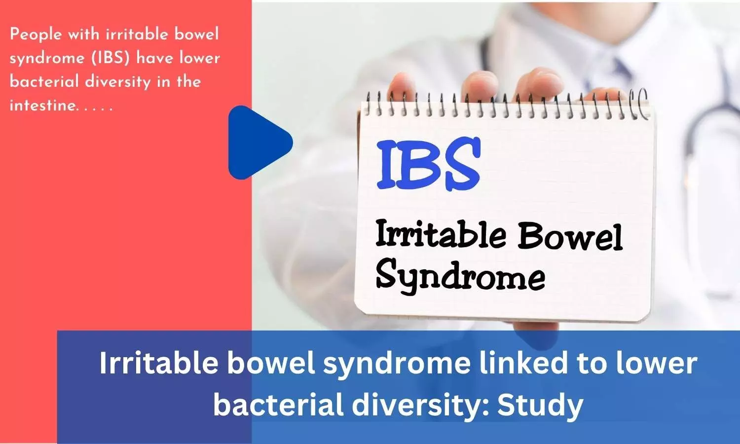 Irritable bowel syndrome linked to lower bacterial diversity: Study