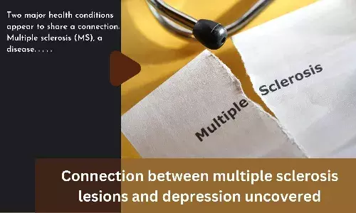 Connection between multiple sclerosis lesions and depression uncovered