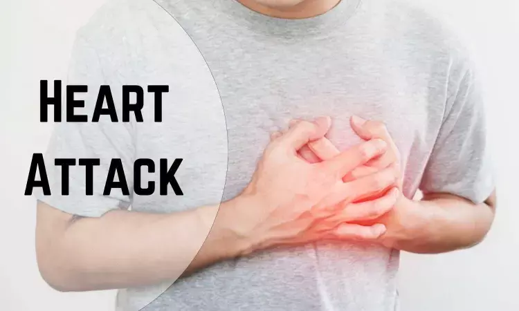 New AI tool outperforms current approaches to detect heart attacks accurately