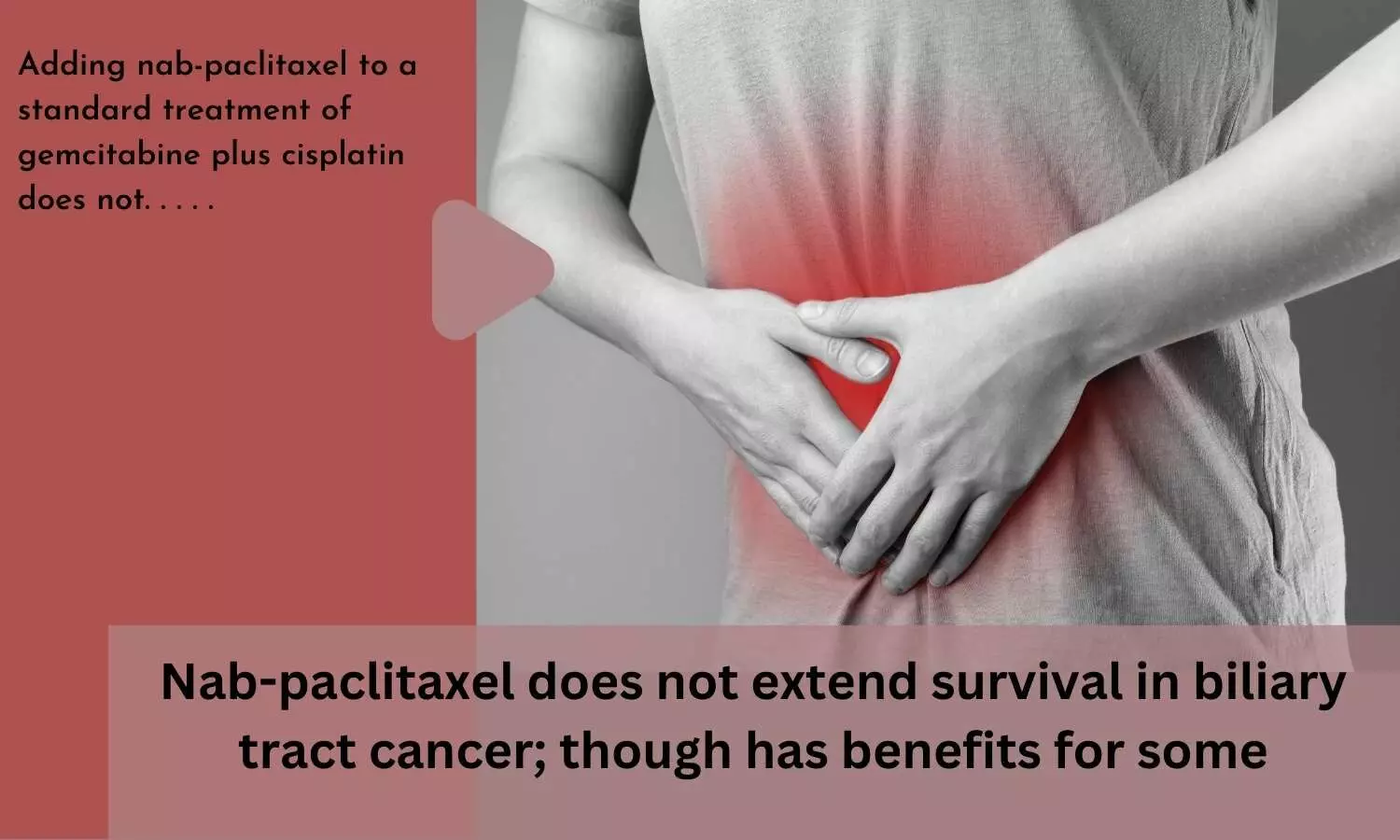 Nab-paclitaxel does not extend survival in biliary tract cancer; though has benefits for some