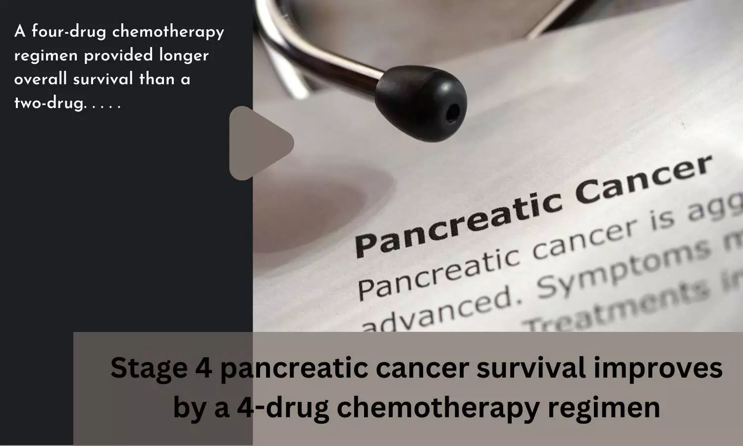 Stage 4 pancreatic cancer survival improves by a 4-drug chemotherapy regimen