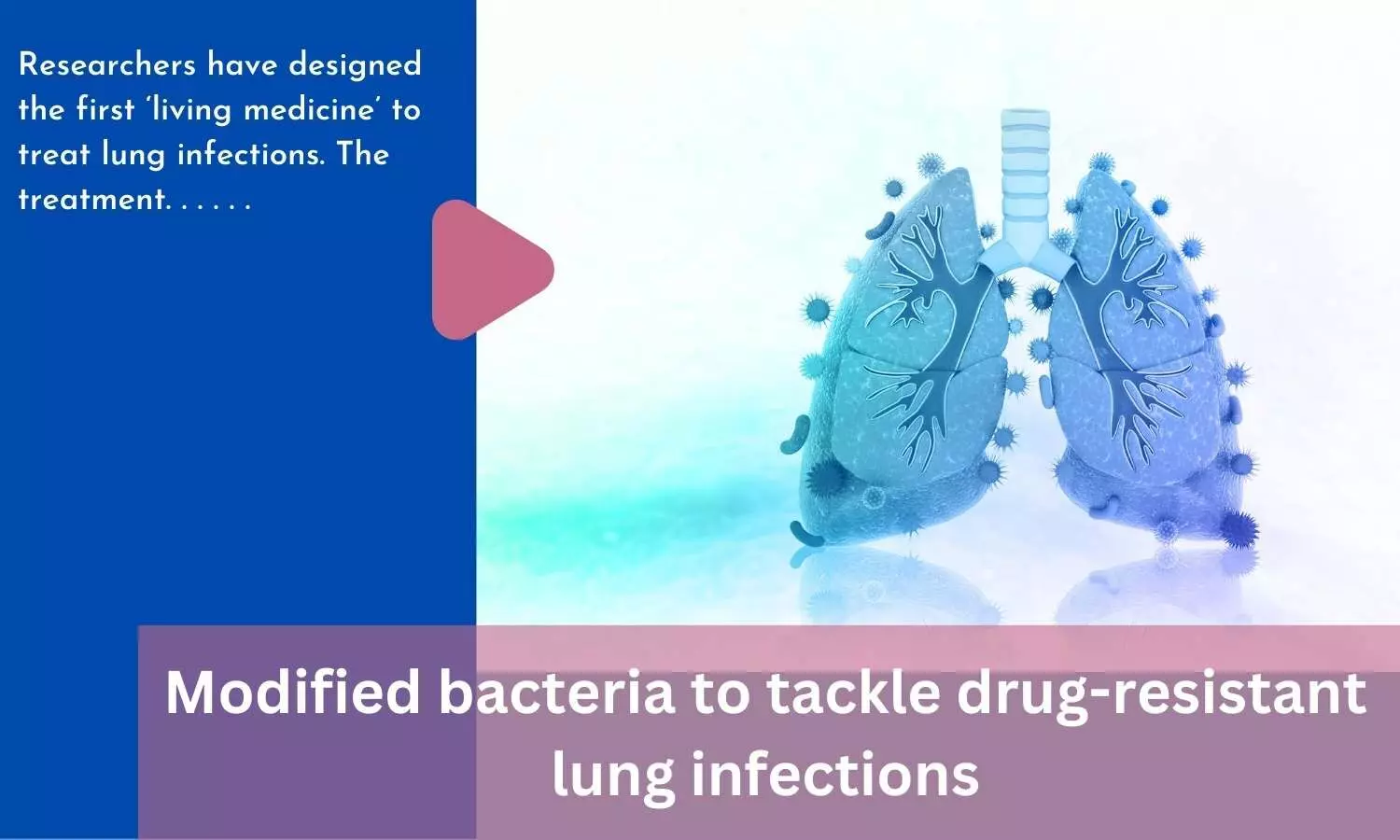 Modified bacteria to tackle drug-resistant lung infections