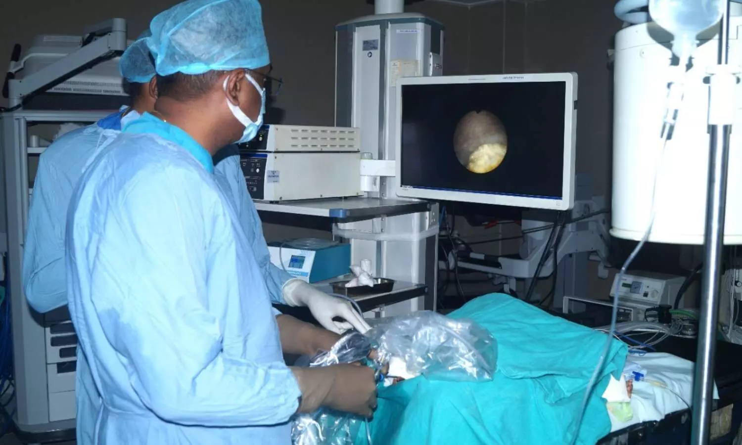 Hyderabad: AINU doctors remove urinary bladder stones of 1.6 cm each from 3-year-old boy