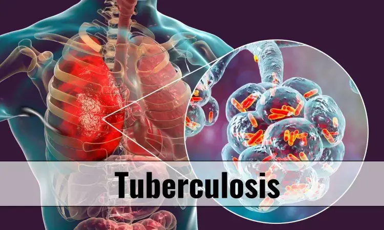 New Disease-Severity Score may Predicts Mortality Risk in Pulmonary TB