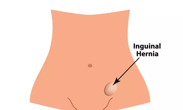 In total extraperitoneal inguinal hernia repair, placing drainage tube improves postoperative recovery