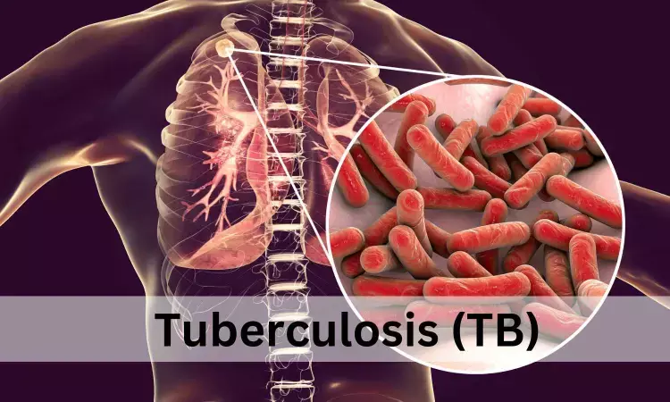 Levofloxacin may reduce risk of developing multidrug-resistant tuberculosis in both children and adults