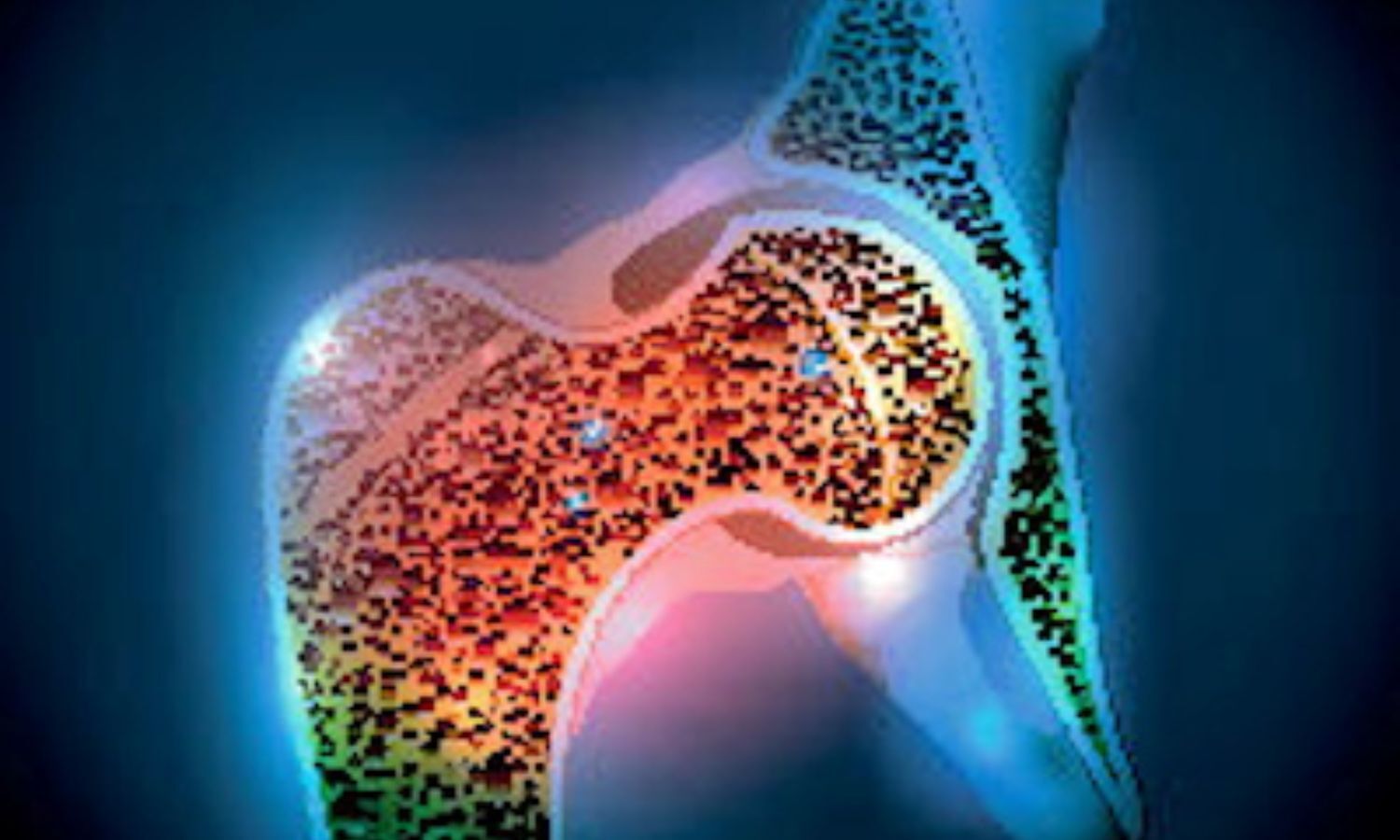 MRI useful for the assessment of bone health in postmenopausal women: Study