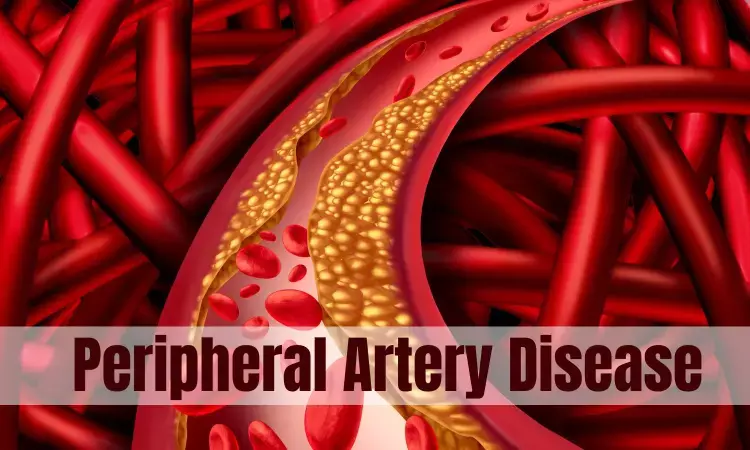 Type 2 diabetes may increase risk of extracranial large artery disease: Lancet