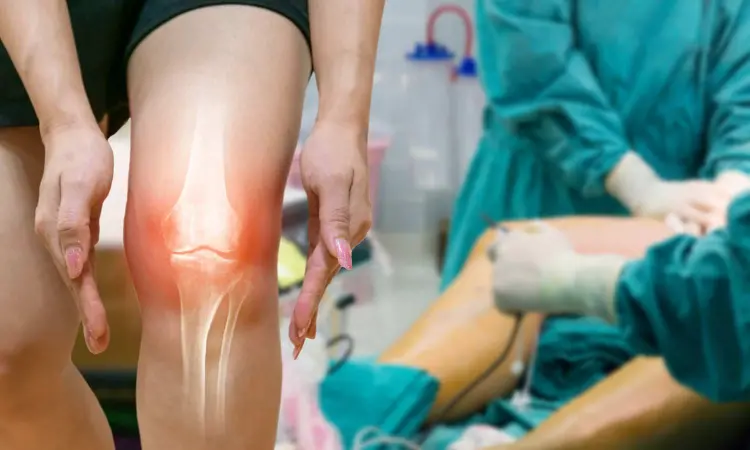 New blood may accurately identify knee osteoarthritis progression