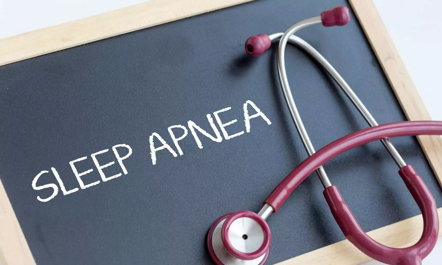 Obstructive sleep apnea linked with low bone mineral density: Study