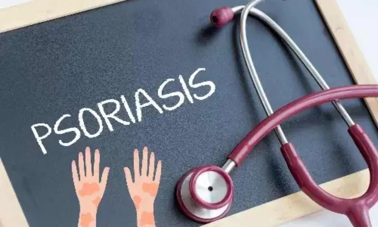 Patients with severe psoriasis have higher risk of heart disease,   new study provides further evidence