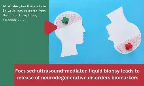Focused-ultrasound-mediated liquid biopsy leads to release of neurodegenerative disorders biomarkers