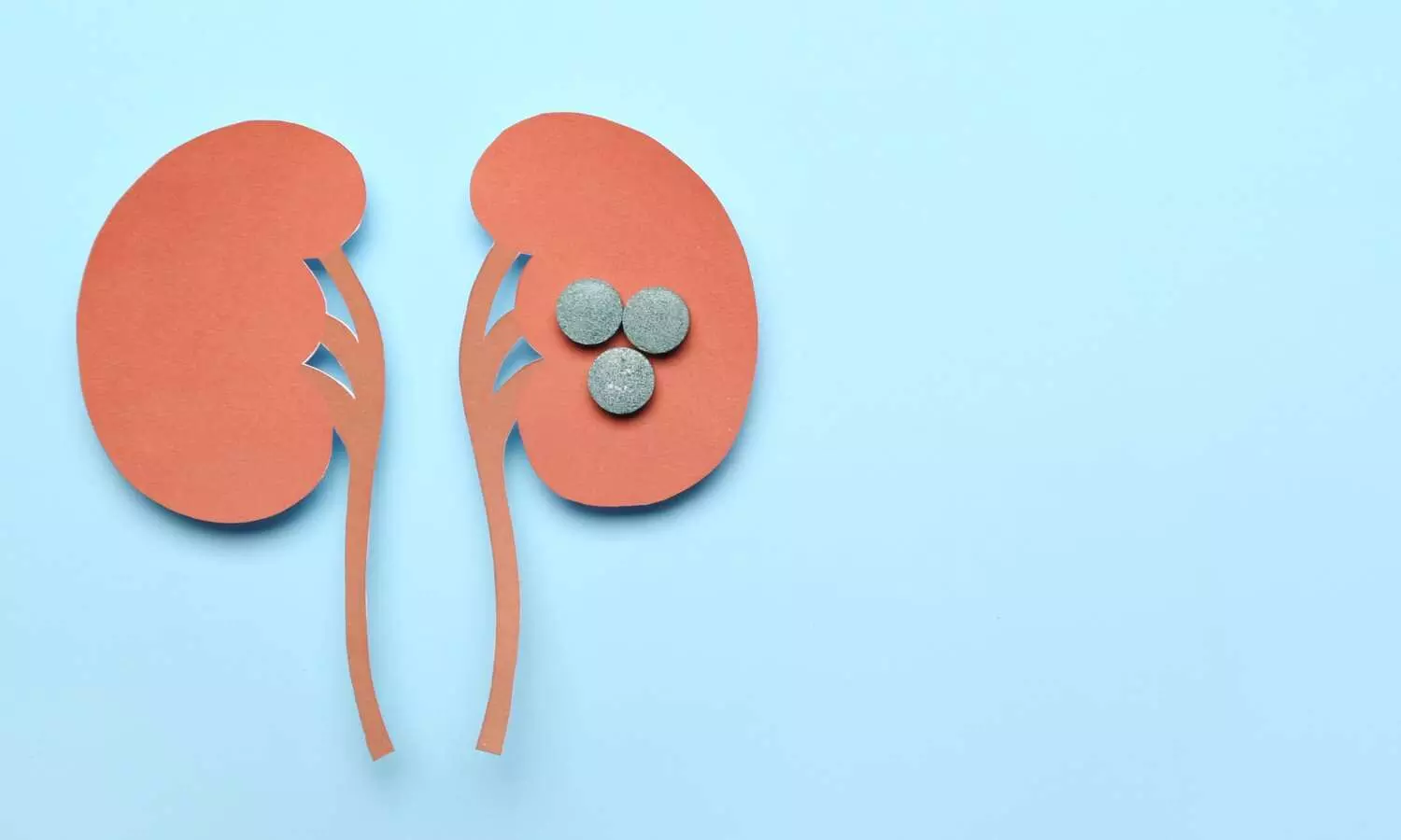 FDA approves oral daprodustat for treating anaemia in CKD patients on dialysis