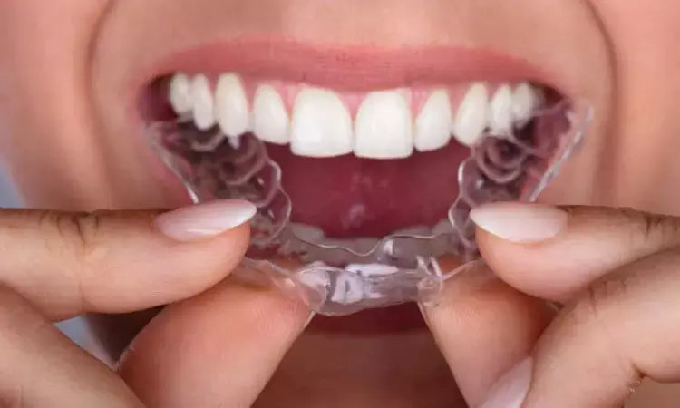 Clear aligners have greater impact on speech than fixed appliances
