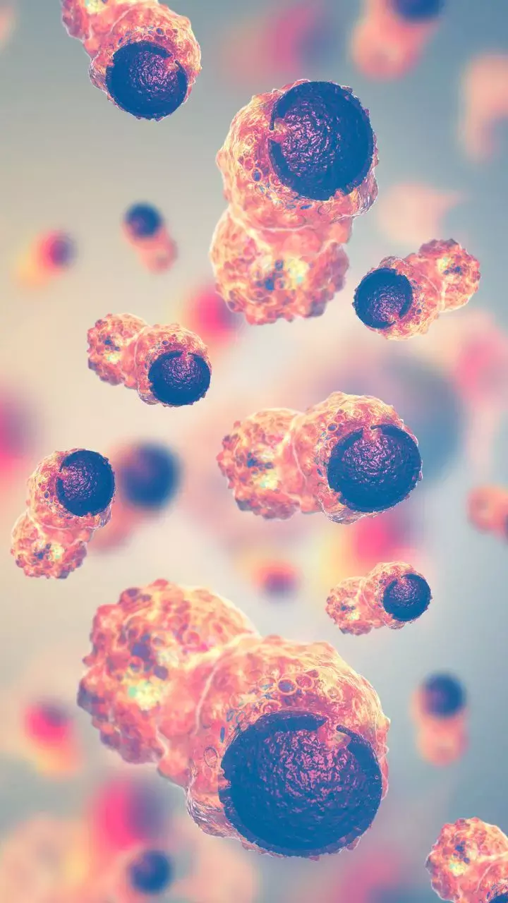 Study Links Type 2 Diabetes To Risk Of Increased Cancer Mortality