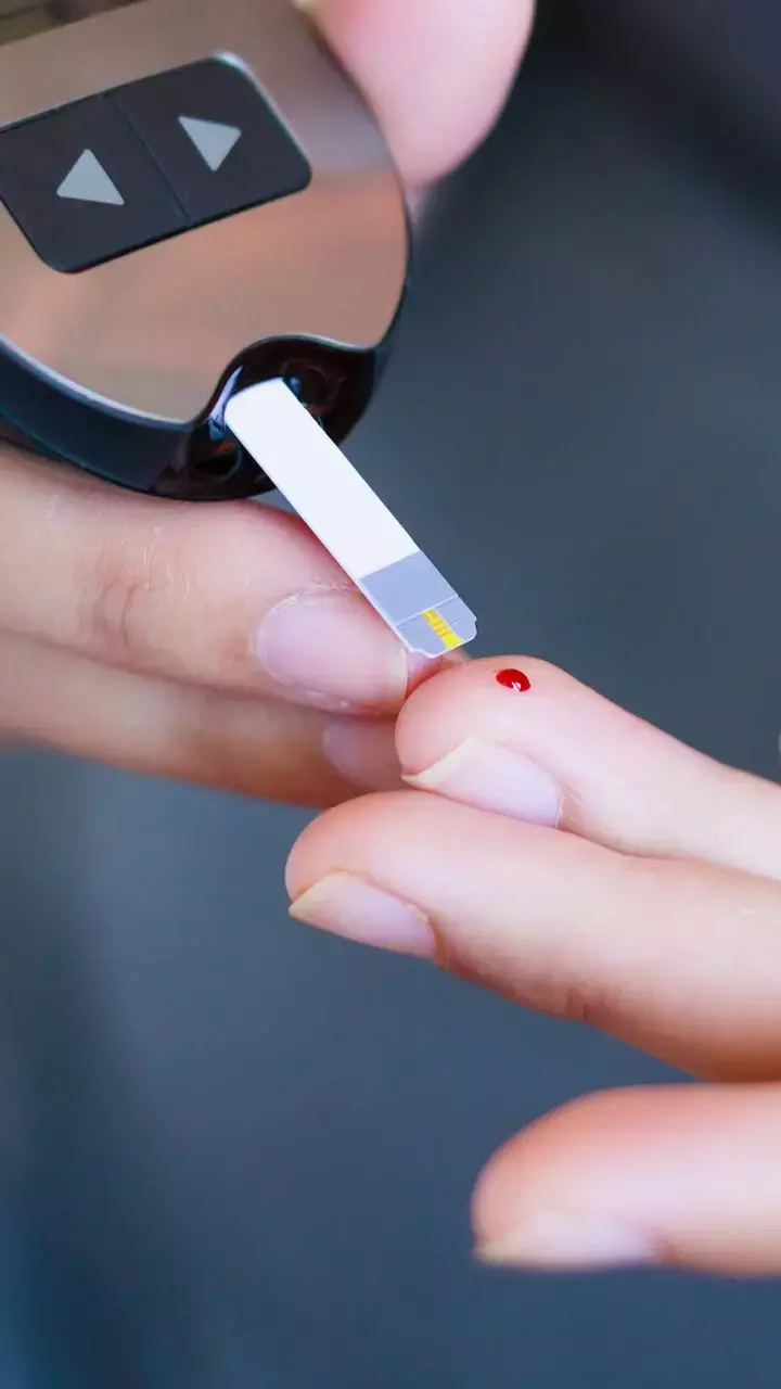 Delayed Development Of Type 2 Diabetes In Adults With Prediabetes Linked With Vitamin D Intake