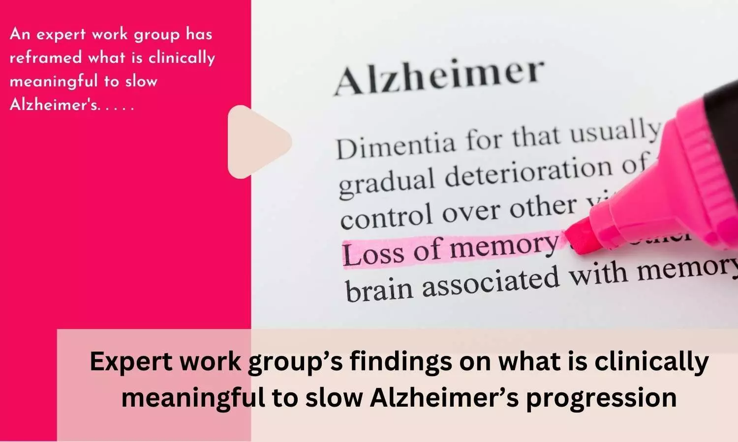 Expert work groups findings on what is clinically meaningful to slow Alzheimers progression