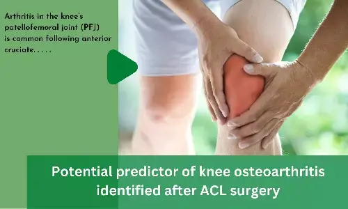 Potential predictor of knee osteoarthritis identified after ACL surgery
