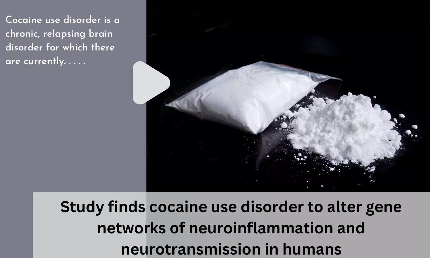 Study finds cocaine use disorder to alter gene networks of neuroinflammation and neurotransmission in humans