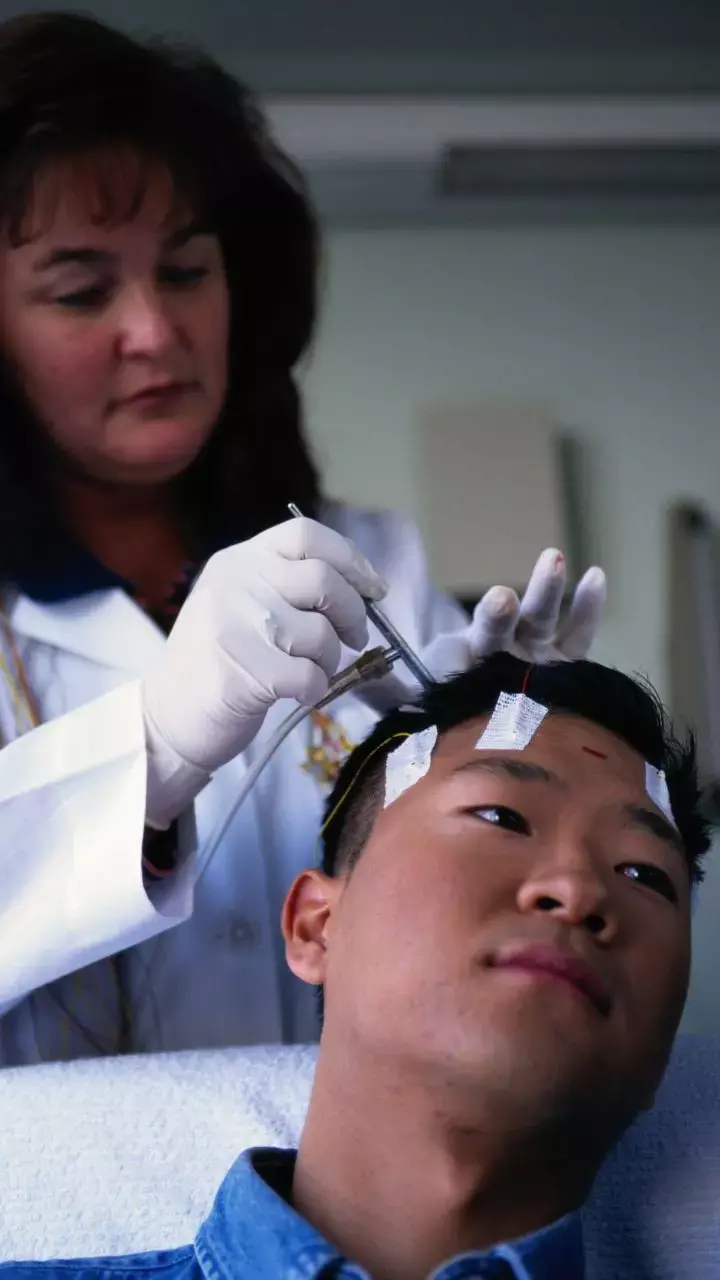 International Epilepsy Day 2023