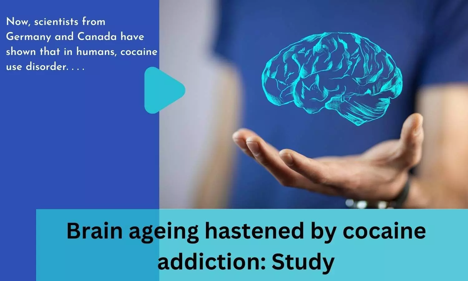 Brain ageing hastened by cocaine addiction: Study