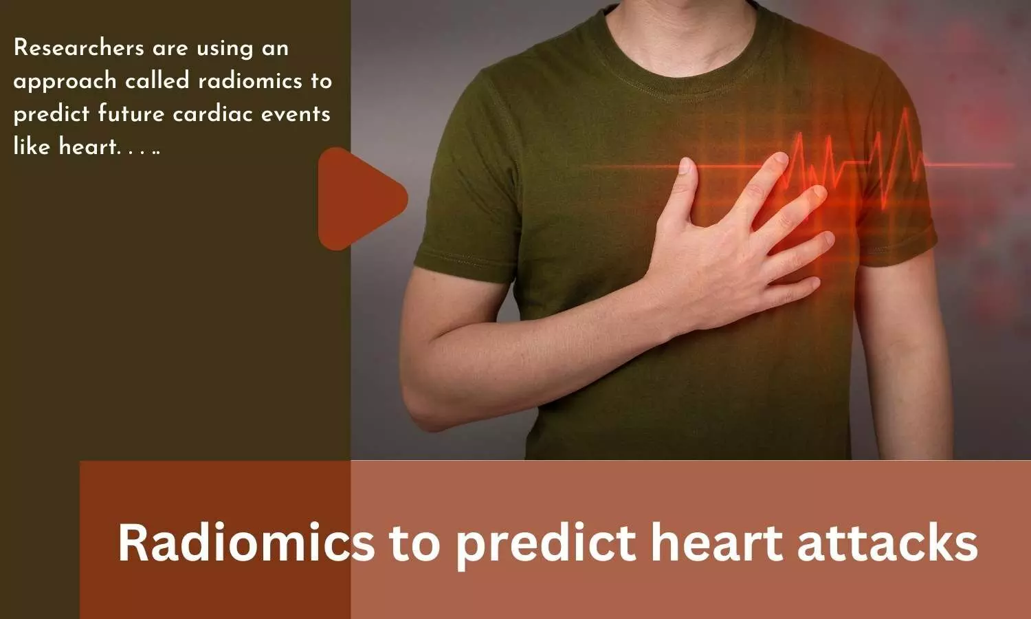 Radiomics to predict heart attacks