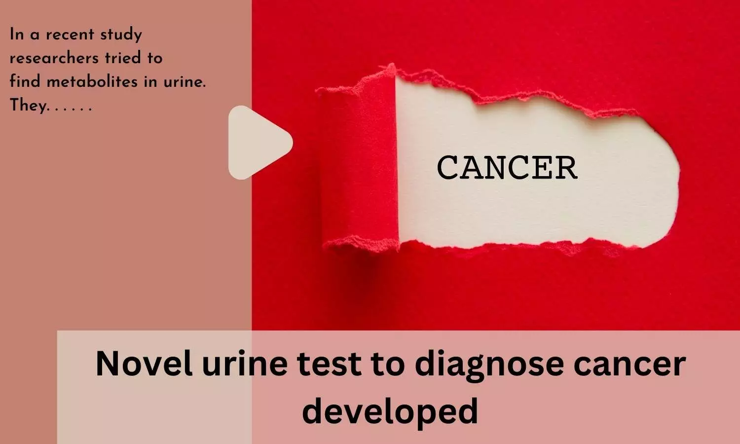 Novel urine test to diagnose cancer developed