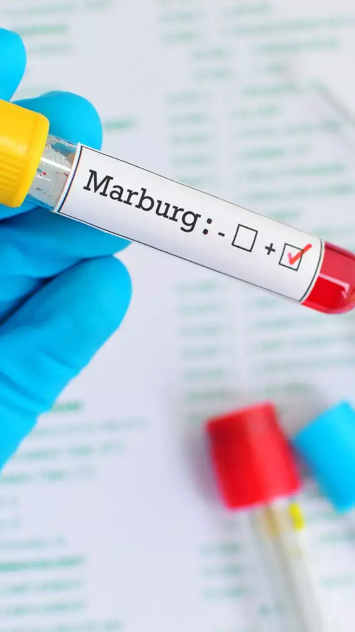 WHO Confirms Marburg Virus Outbreak In Equatorial Guinea, Check Out Symptoms And Treatment