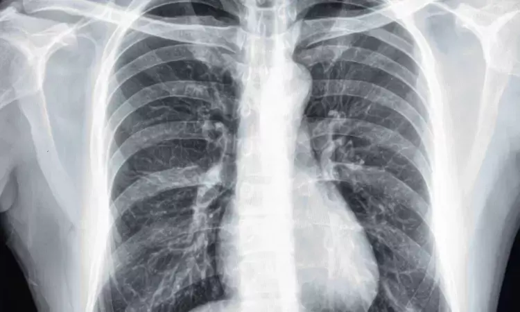 Photon-counting CT may evaluate lung structure and function