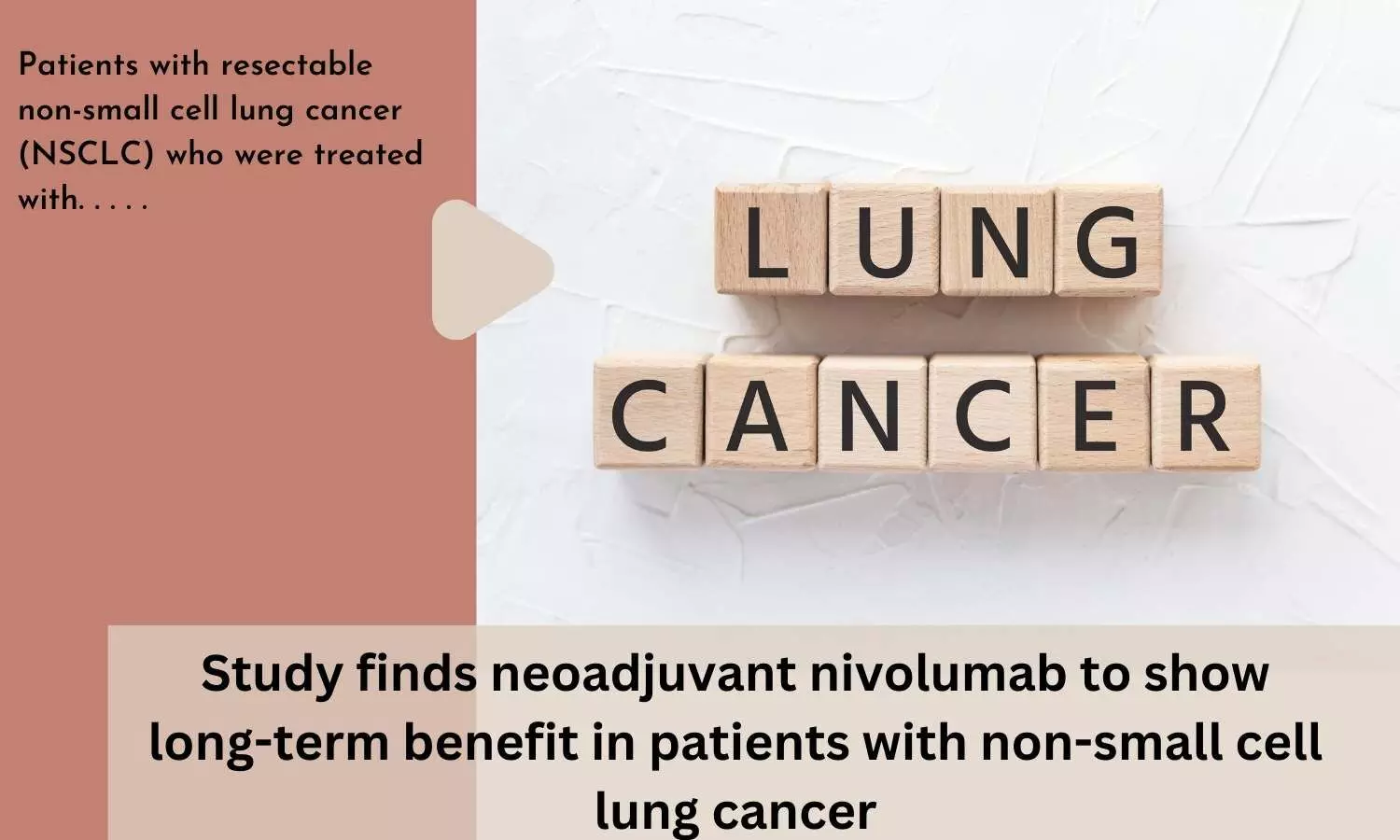 Study finds neoadjuvant nivolumab to show long-term benefit in patients with non-small cell lung cancer