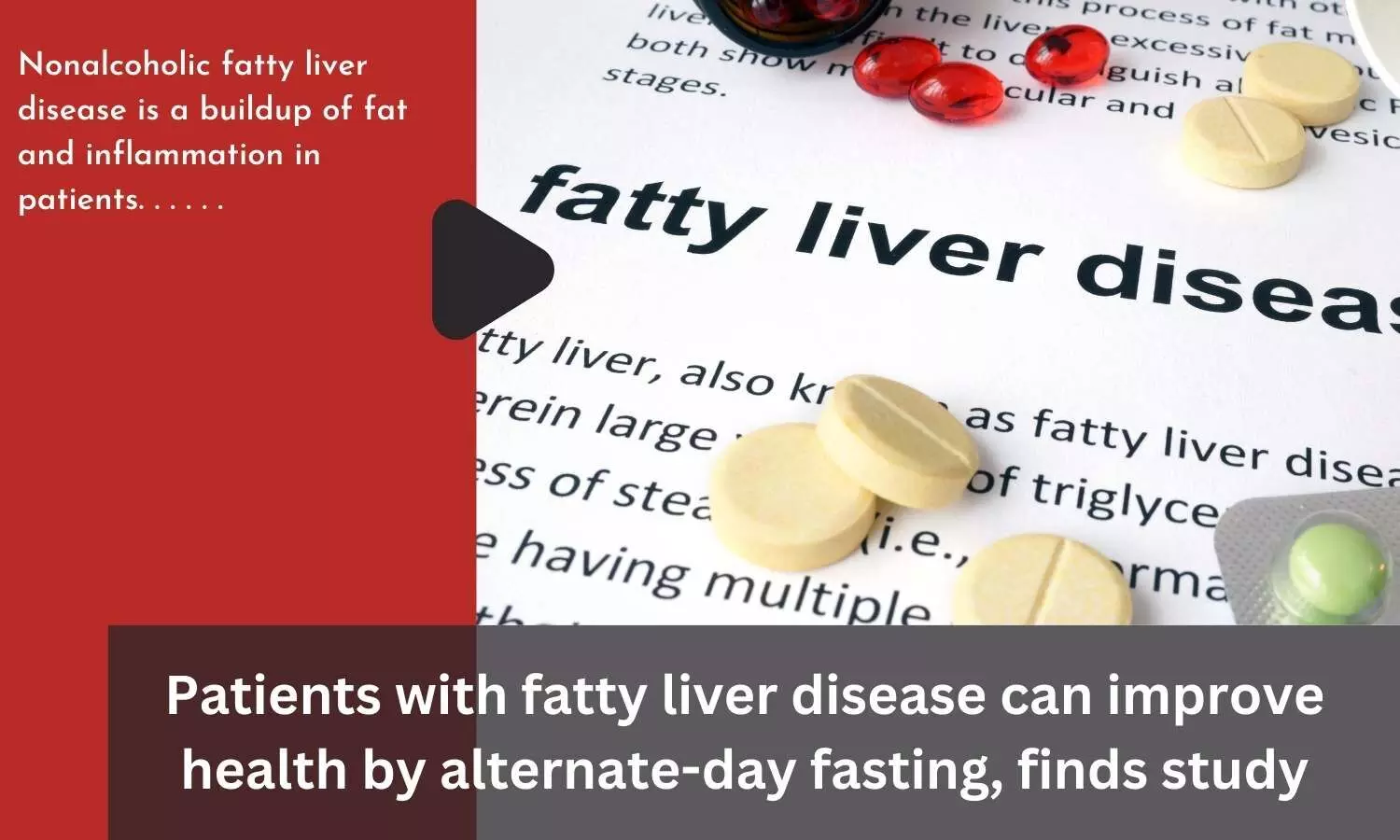 Patients with fatty liver disease can improve health by alternate-day fasting, finds study
