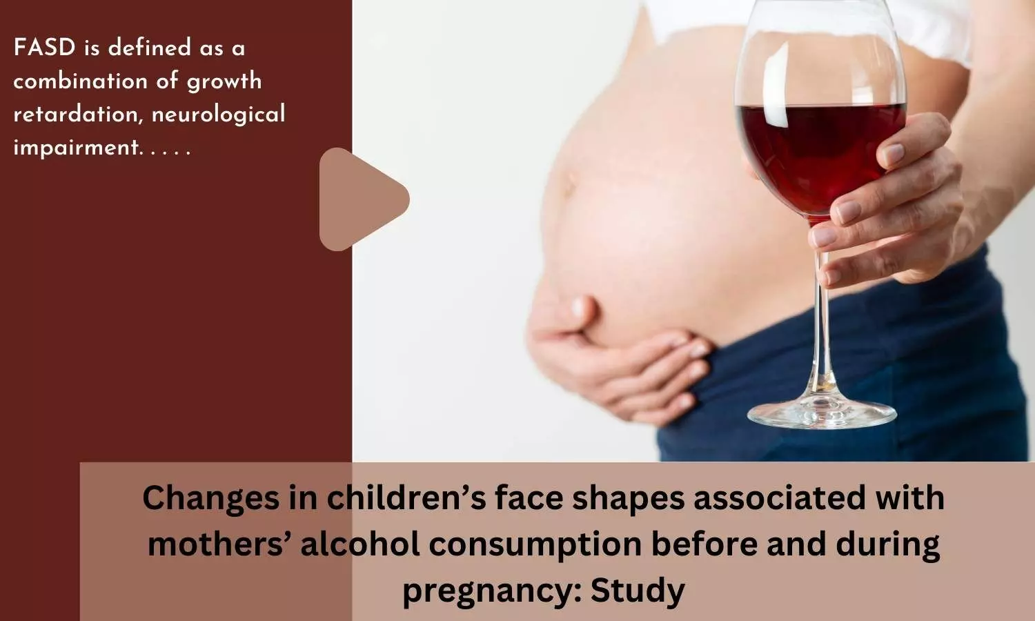 Changes in childrens face shapes associated with mothers alcohol consumption before and during pregnancy: Study