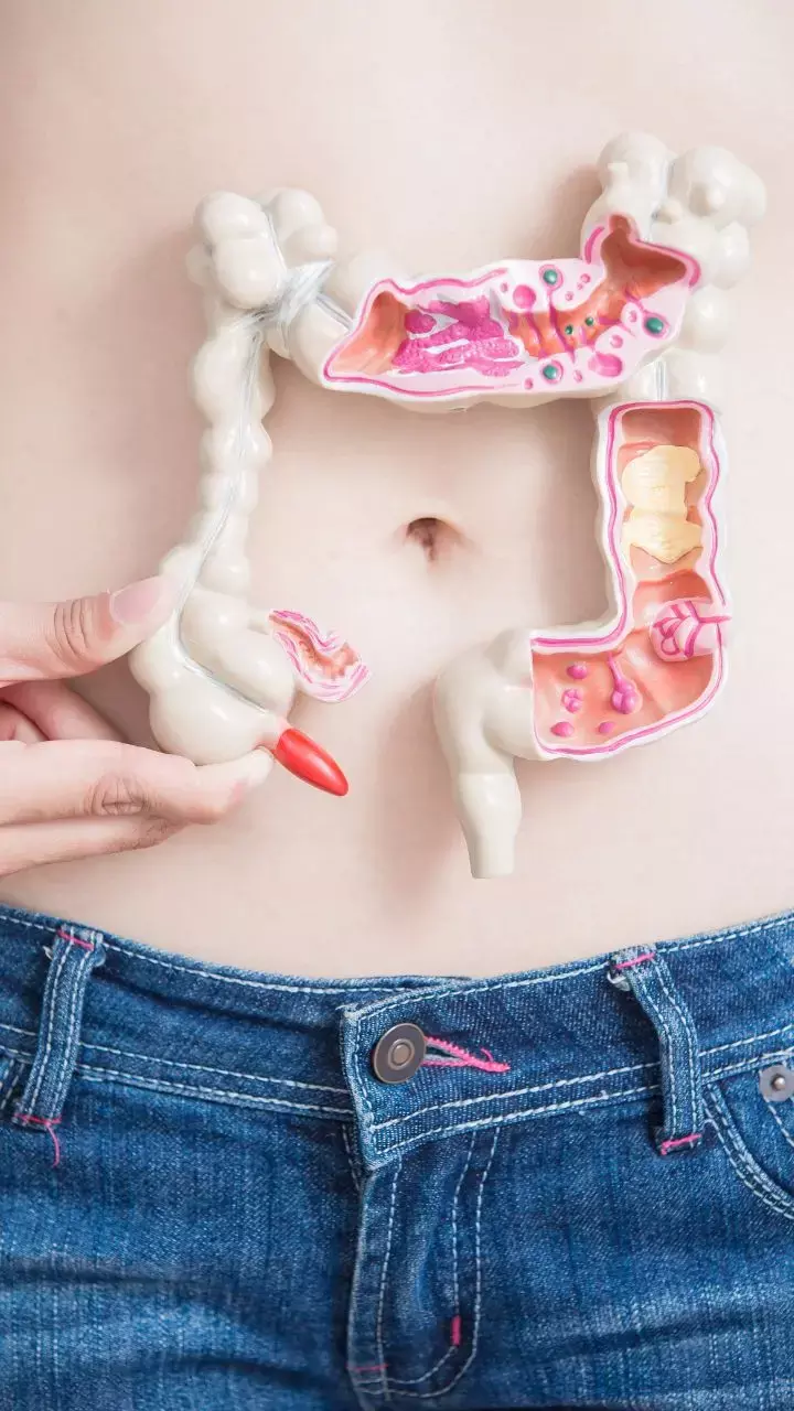 Mental Health issues Linked With Poor Gut Health