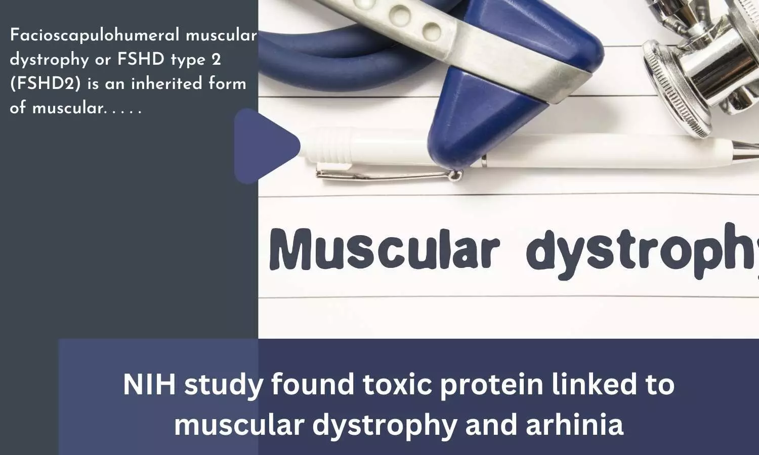 NIH study found toxic protein linked to muscular dystrophy and arhinia