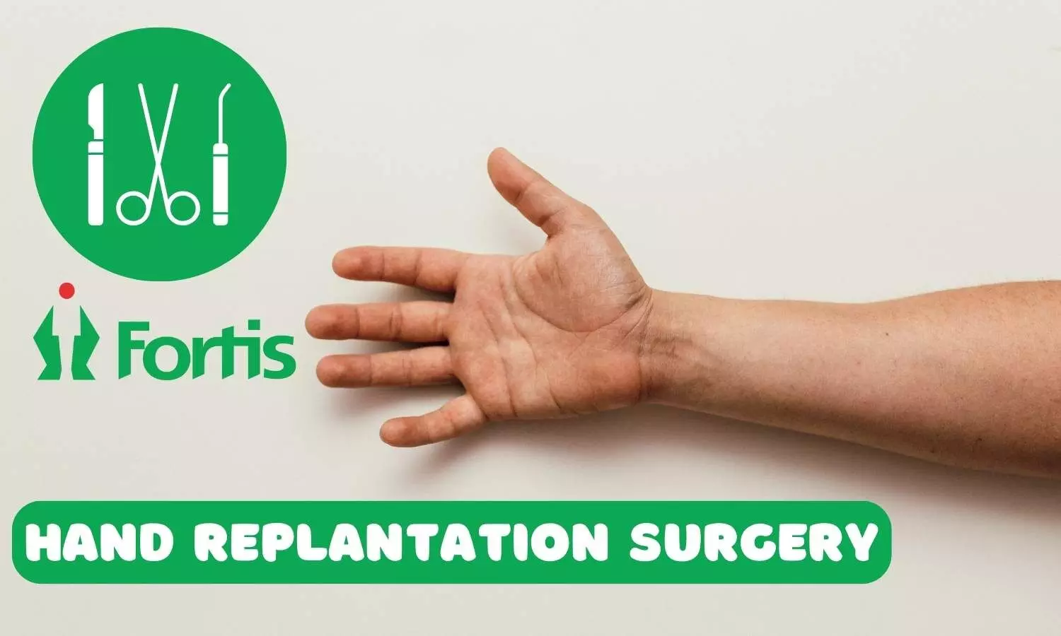 Fortis Hospital doctors perform complex hand replantation surgery on 51-year-old factory manager