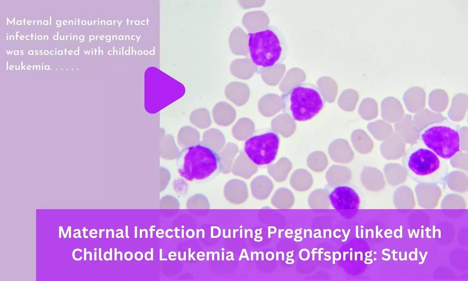 Maternal infection during pregnancy linked with childhood Leukemia among offspring: Study