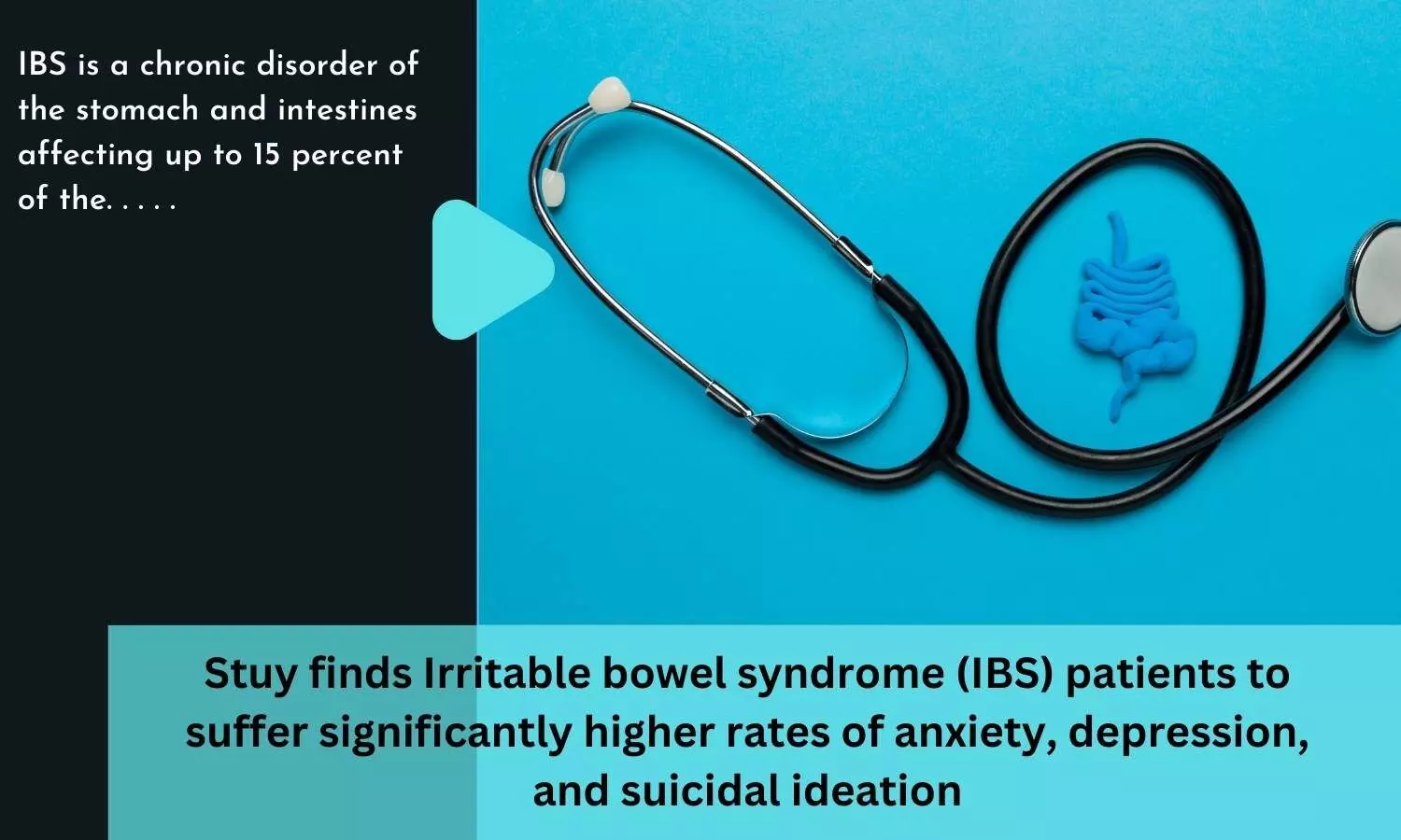 Stuy finds Irritable bowel syndrome (IBS) patients to suffer significantly higher rates of anxiety, depression, and suicidal ideation