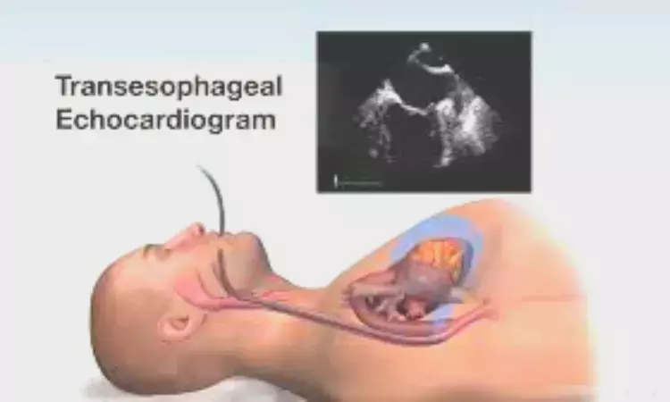 Transoesophageal Echocardiography Proves Vital for assessing residual lesions during Pediatric Heart Surgery