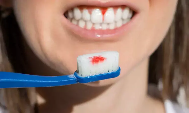 High fasting  blood sugar linked to periodontal disease in Kidney Transplant patients