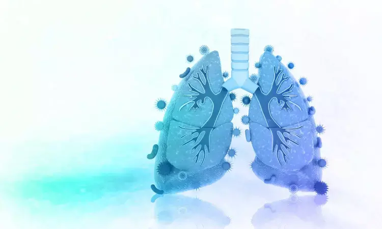 A probiotic for our lungs? New research poses questions about the future of treating COVID-19